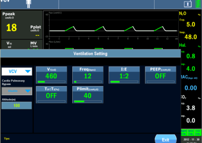 Avacs 50 anesthesia unit