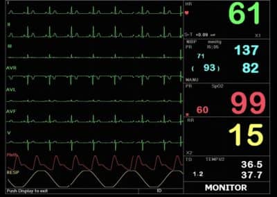 Macs 20 Moniteur pour les patients, multi paramètres