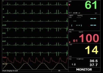 Macs 20 Moniteur pour les patients, multi paramètres