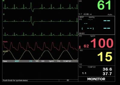 Macs 20 Moniteur pour les patients, multi paramètres