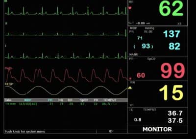 Macs 20 Moniteur pour les patients, multi paramètres