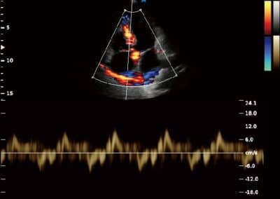 Ultrasound system Sonos 10